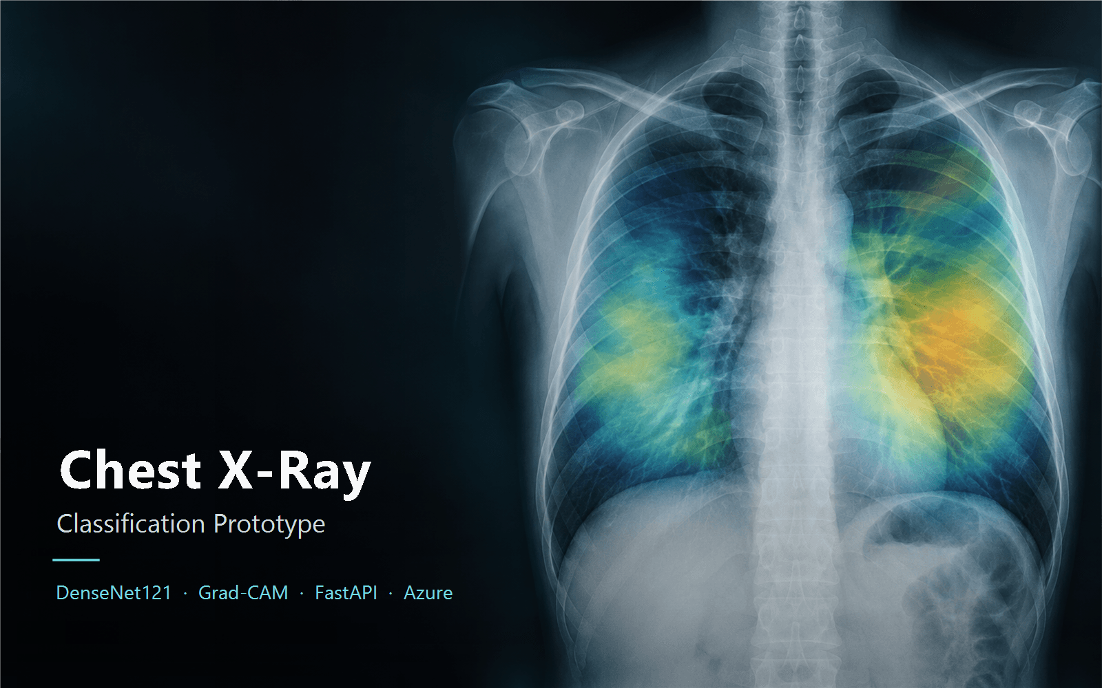 Chest X-Ray MLOps System presentation cover