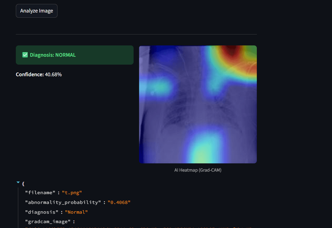 Chest X-Ray MLOps interface displaying a chest radiograph alongside a Grad-CAM heatmap highlighting image regions that influenced the model prediction.
